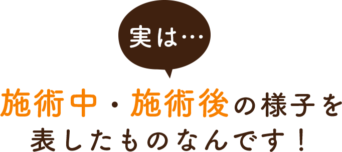 実は施術中・施術後の様子を表したものなんです！